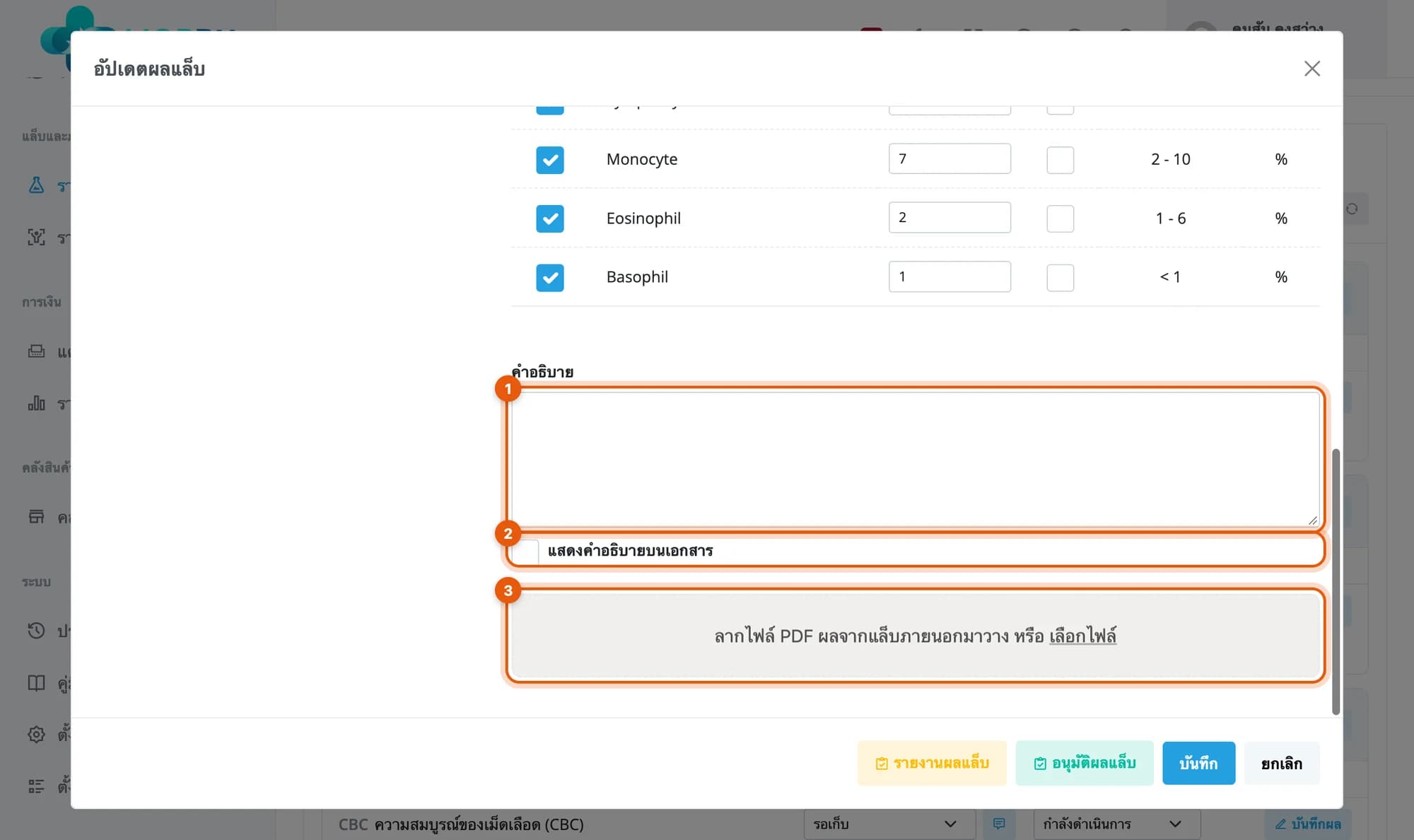 ช่องคำอธิบาย ช่องติ๊กแสดงคำอธิบายบนเอกสาร และช่องแนบไฟล์ PDF ในกล่องอัปเดตผลแล็บ