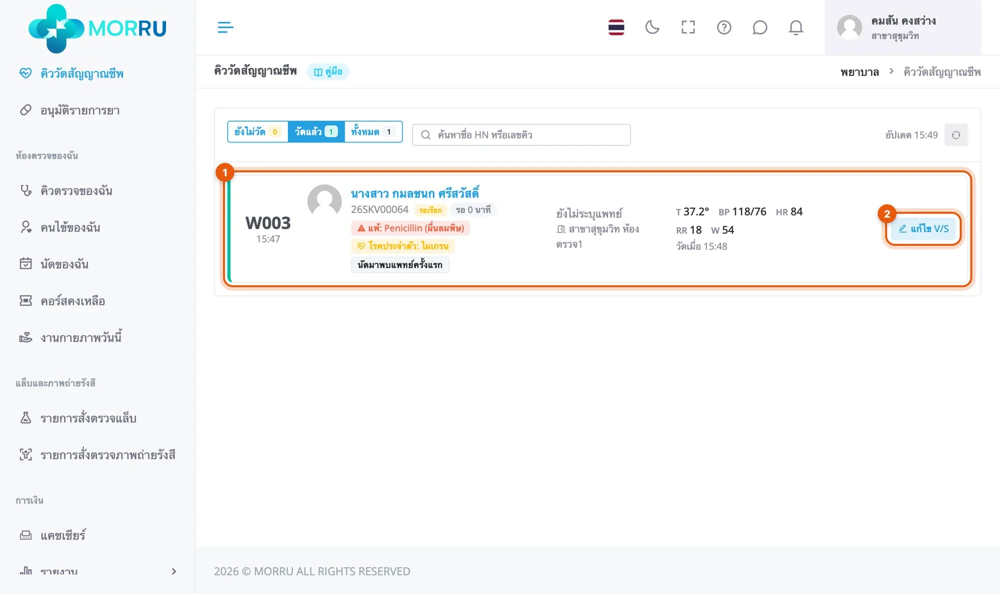 แท็บวัดแล้ว แถวคิว W003 แสดงอุณหภูมิ ความดัน ชีพจร การหายใจ น้ำหนัก เวลาที่วัด และปุ่มแก้ไข V/S